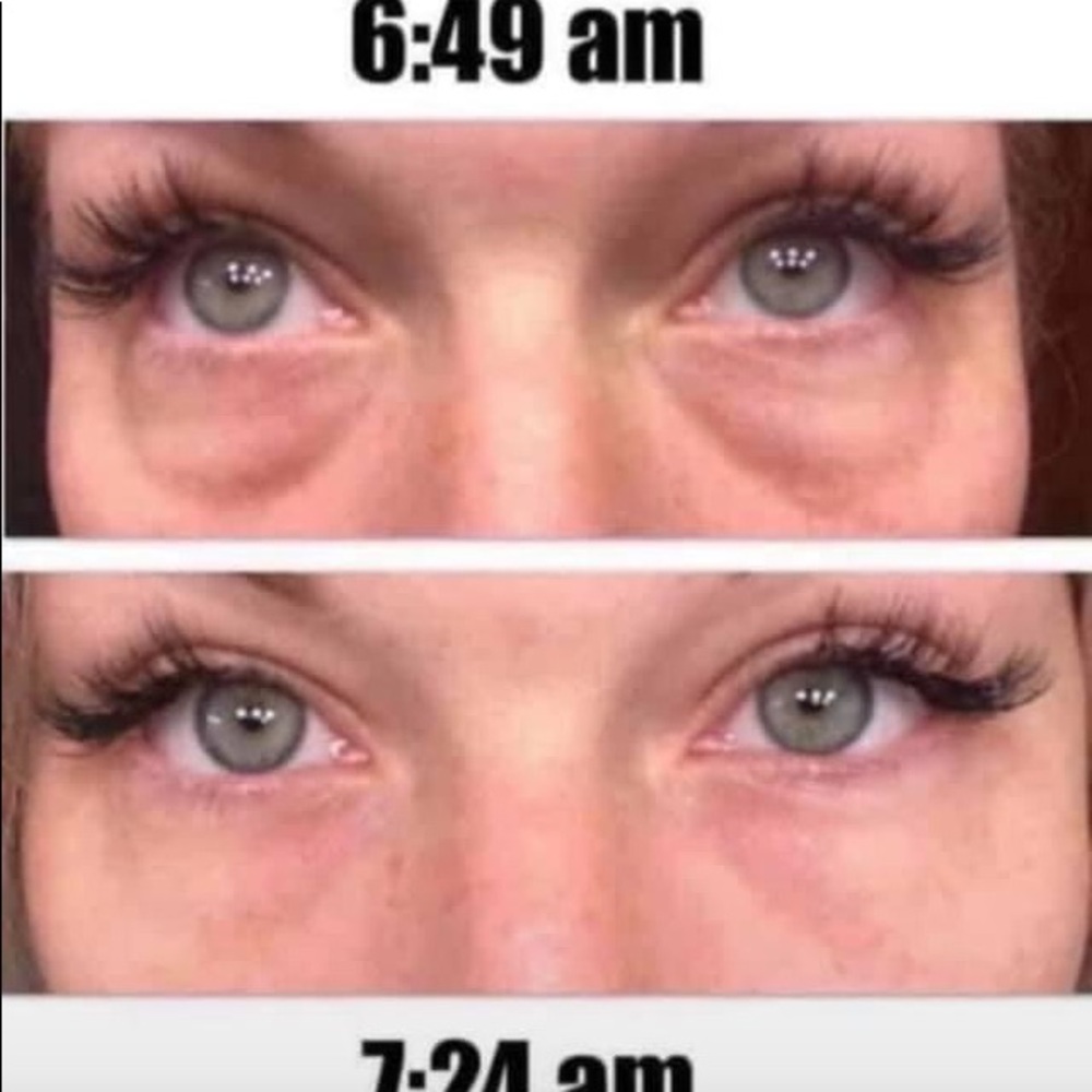 Neora hydrogel eye patches